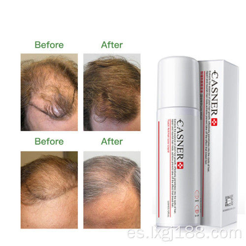 spray de crecimiento rápido de cabello orgánico 100% natural